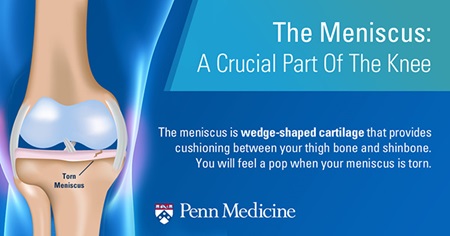 graphic penn meniscus image